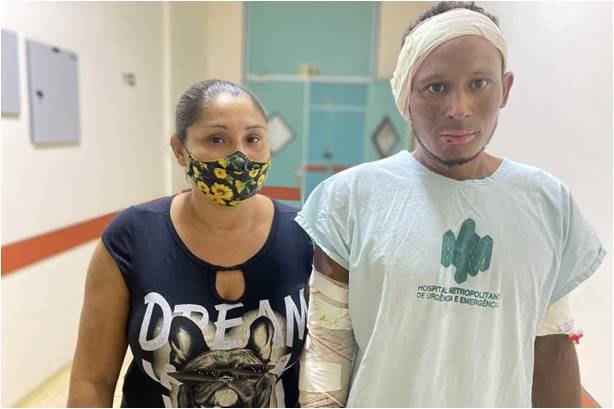 Após acidente em embarcação, paciente vindo de Chaves recebe alta no Hospital Metropolitano Após acidente em embarcação, paciente vindo de Chaves recebe alta no Hospital Metropolitano
