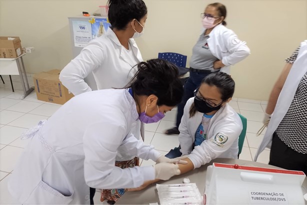 Sespa capacita técnicos para detecção da tuberculose por meio do PPD Sespa capacita técnicos para detecção da tuberculose por meio do PPD