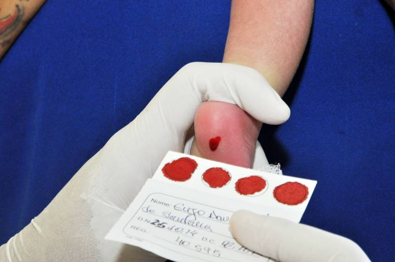 Sespa ressalta a importância do Teste do Pezinho para todos os recém-nascidos Sespa ressalta a importância do Teste do Pezinho para todos os recém-nascidos