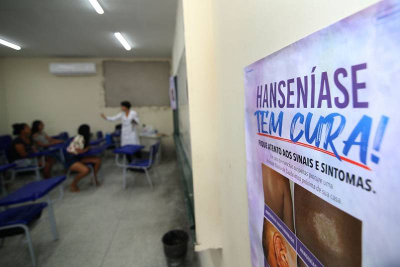 Sespa inicia campanha do Janeiro Roxo para conscientizar população sobre hanseníase Sespa inicia campanha do Janeiro Roxo para conscientizar população sobre hanseníase