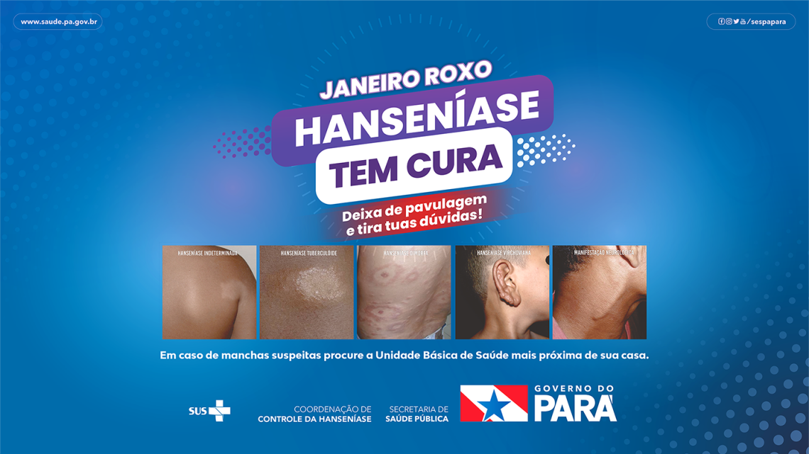 Campanha Janeiro Roxo – 2024 Campanha Janeiro Roxo – 2024