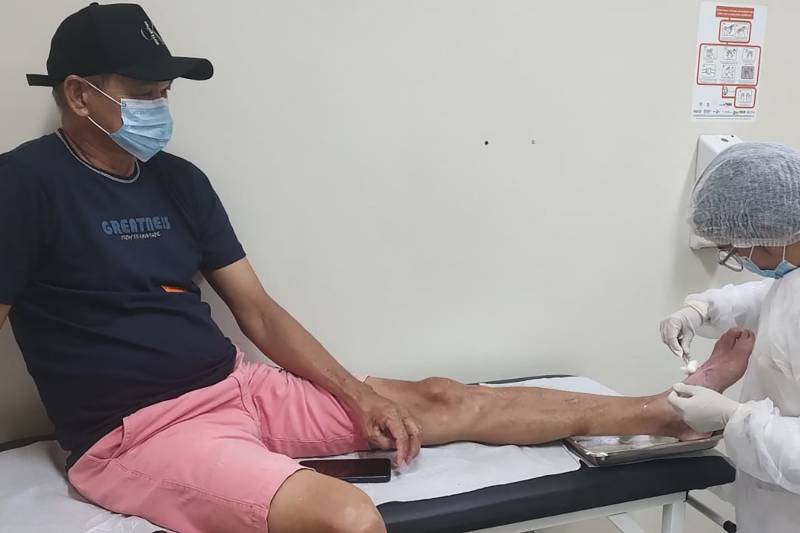Tratamento de feridas tem evitado amputações em pacientes diabéticos no HRBA Tratamento de feridas tem evitado amputações em pacientes diabéticos no HRBA