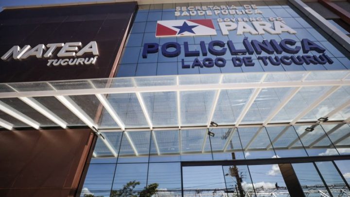 Dia Mundial contra a Obesidade: Policlínica Lago de Tucuruí alerta para riscos da doença crônica