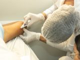 Sespa amplia acesso à saúde reprodutiva com capacitação sobre implante subdérmico no Pará