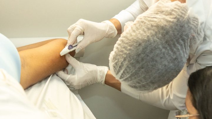 Sespa amplia acesso à saúde reprodutiva com capacitação sobre implante subdérmico no Pará